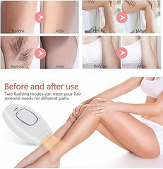 IPL Laser Hair Removal Device for Women – Permanent Painless Hair Reduction for Face, Legs, Bikini & Body – At-Home Beauty Tool